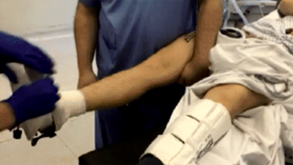 Cognitive Task Analysis improves understanding of femoral IM nailing over standard manual training